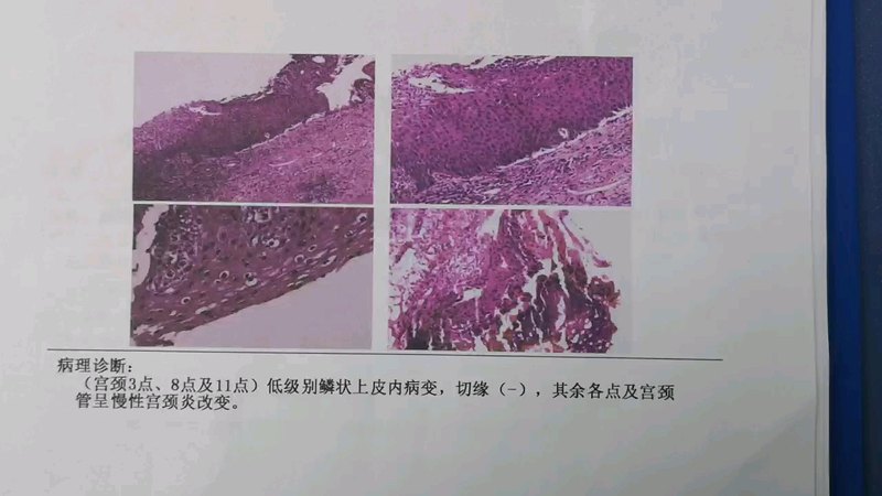視頻封面