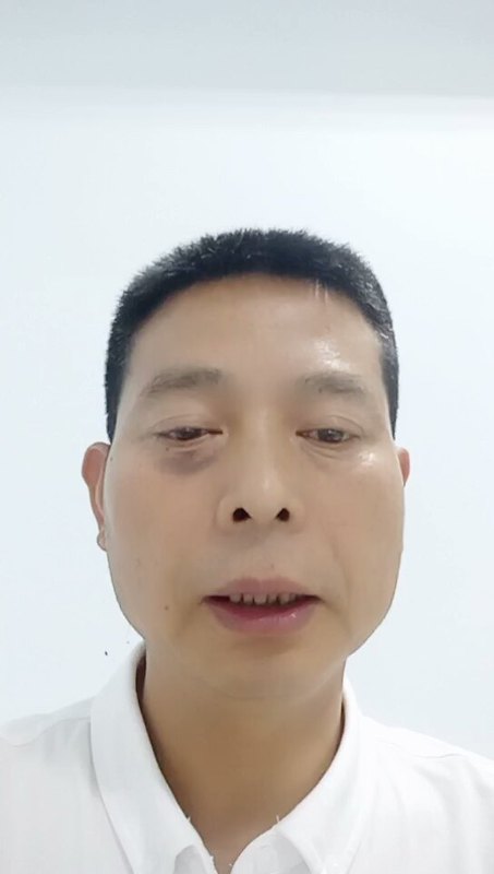 儿童白血病有哪些症状？