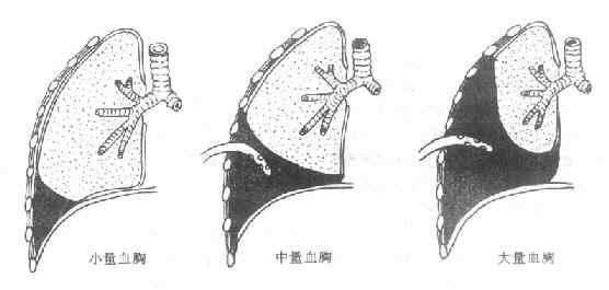 图文图片
