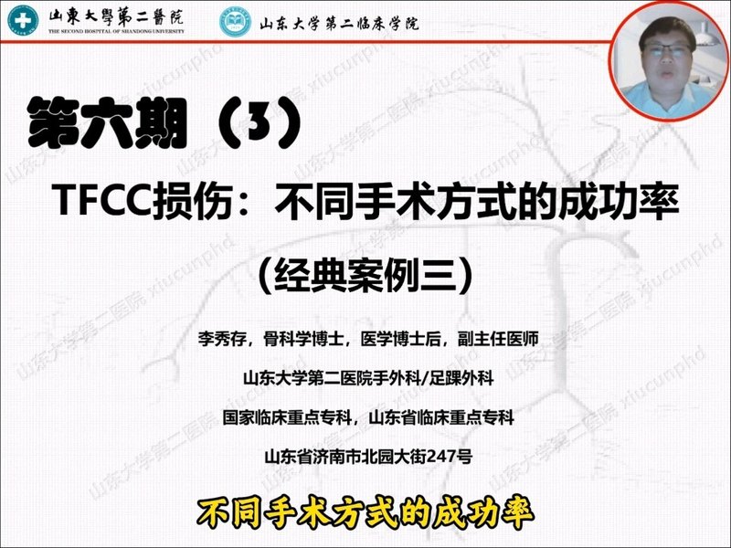 TFCC损伤:不同手术方式的成功率