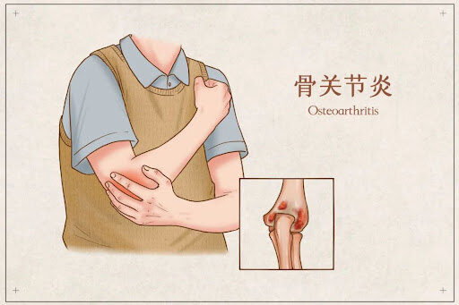 圖文圖片