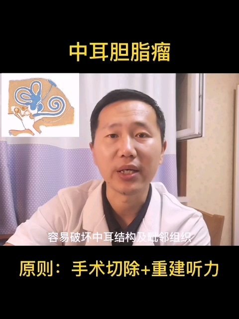中耳胆脂瘤