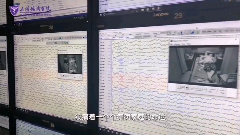 变化多端的脑电图