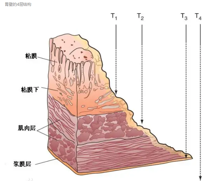 圖文圖片