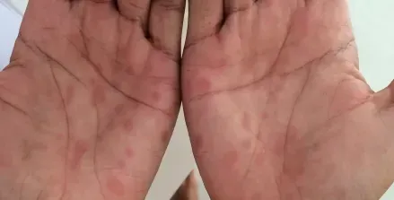圖文圖片