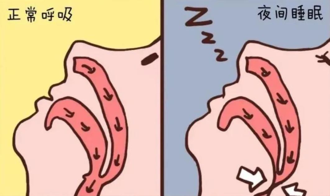 圖文圖片