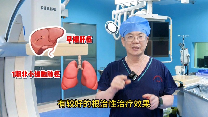 介入手术演示：肿瘤的射频消融是怎么回事？有什么用？
