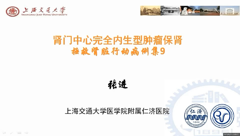 肾门中心肾肿瘤的微创保肾手术