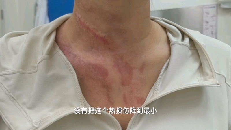 視頻封面