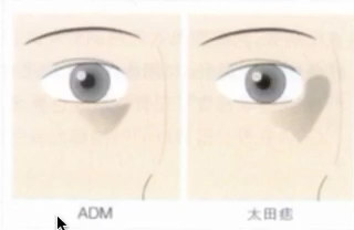 視頻封面