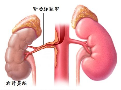 圖文圖片
