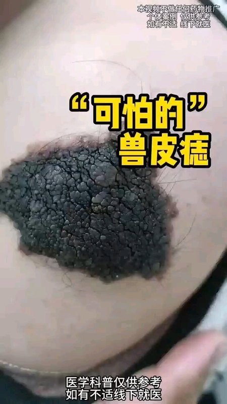 視頻封面