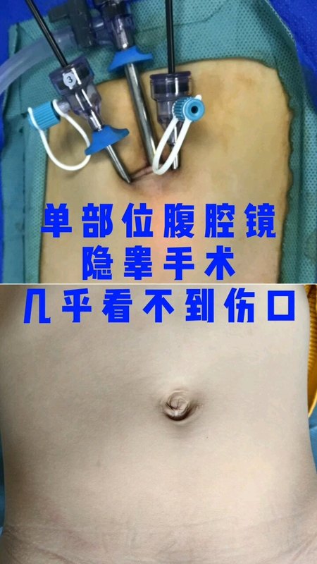 視頻封面