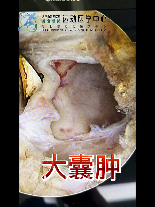視頻封面