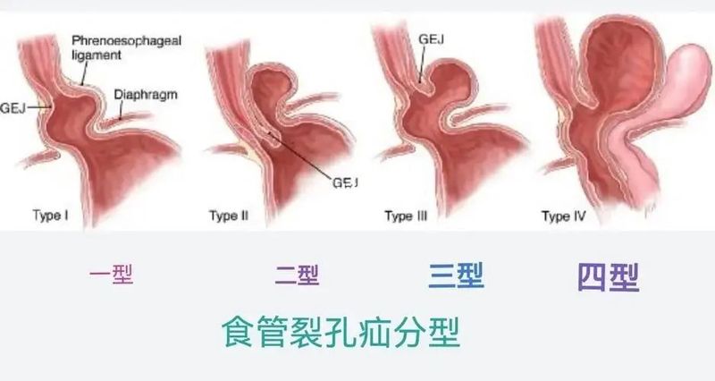 图文图片