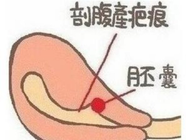 圖文圖片