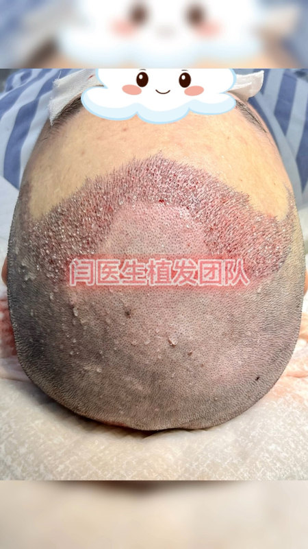視頻封面