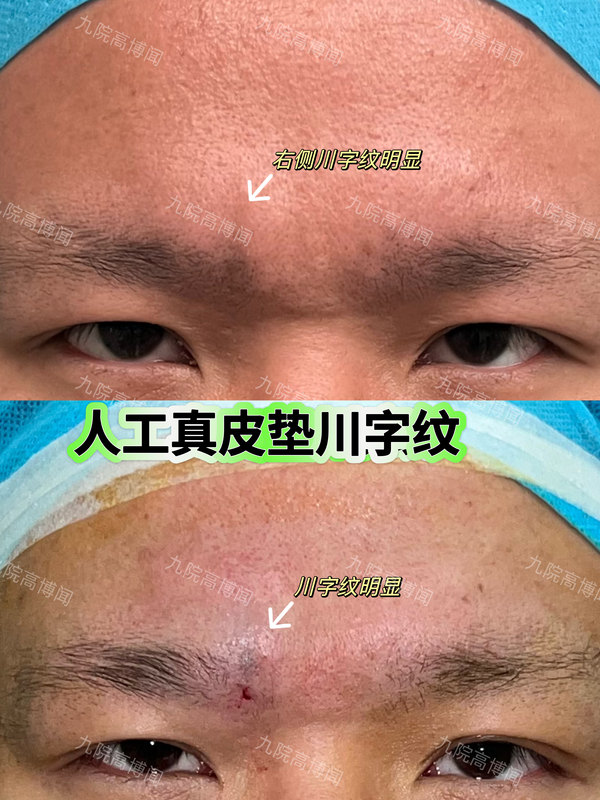 圖文圖片