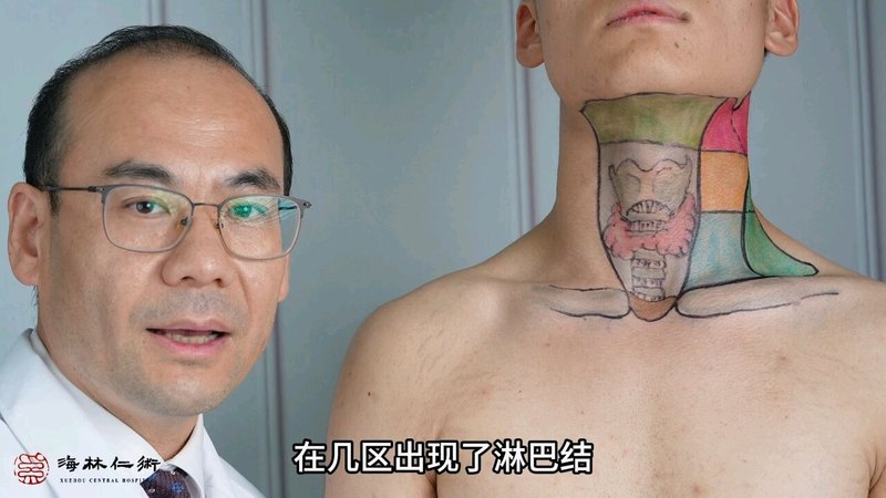 颈部淋巴结分区的意义，示意图