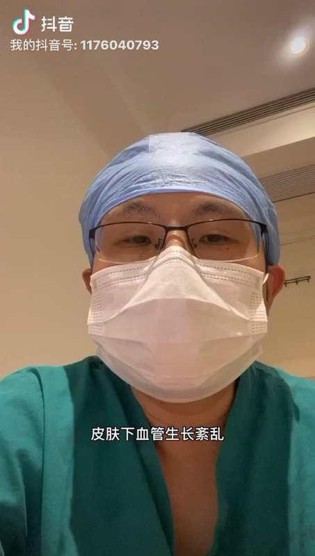 血管性胎记