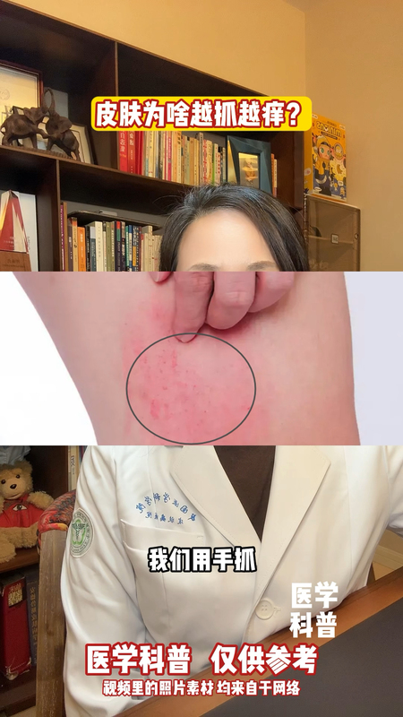 視頻封面