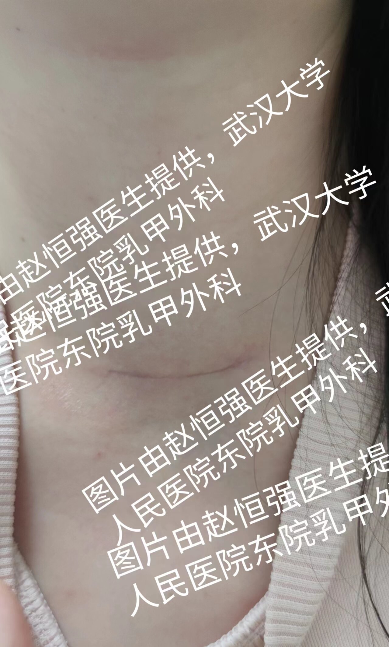 圖文圖片