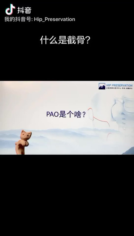 什么是髋臼周围截骨术？PAO是个啥？＃先髋
