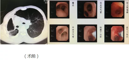 圖文圖片