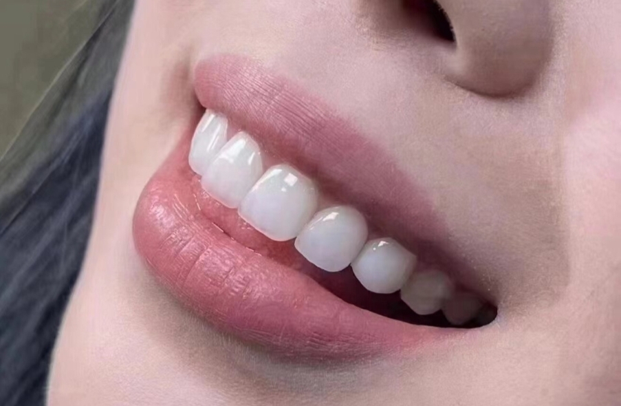 圖片