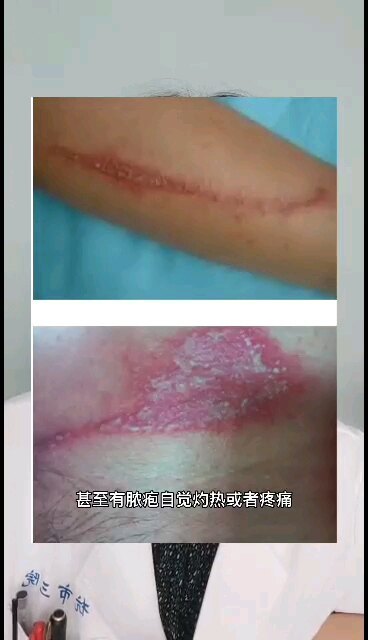 早上起来就发现皮肤出问题了，怎么回事？