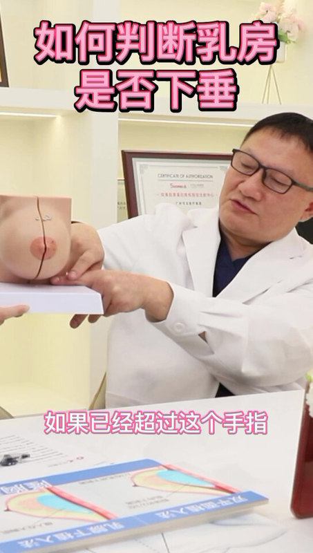 如何通过自测的方式判断乳房是否下垂