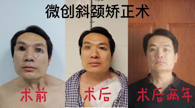 圖文圖片