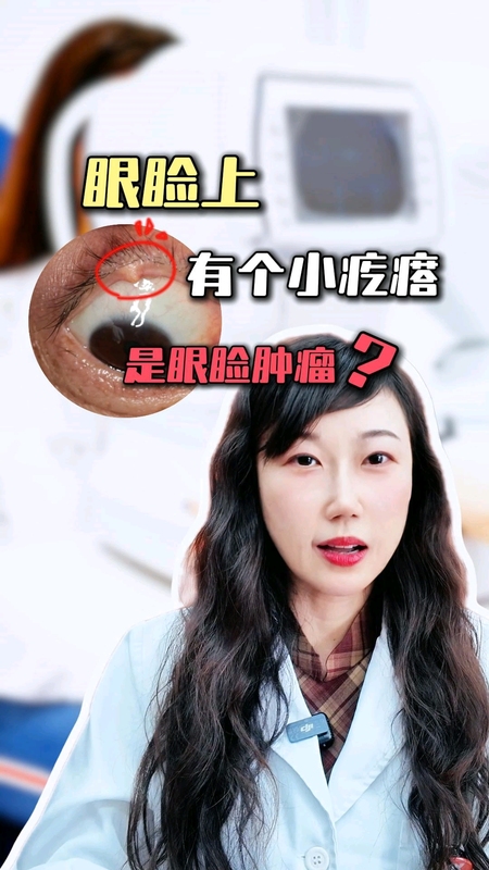 視頻封面