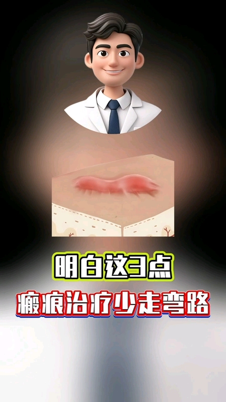 視頻封面