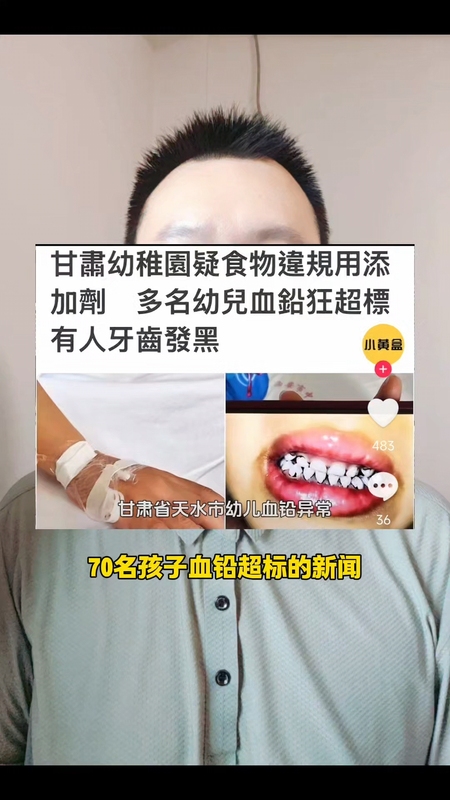 儿童抽动症，警惕铅中毒