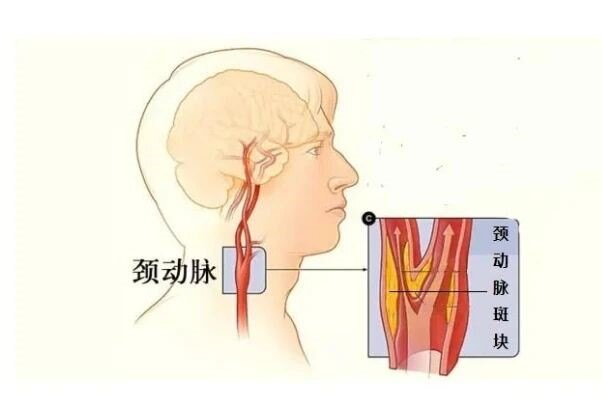 圖文圖片