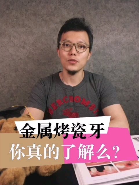 金属烤瓷牙/你真的了解么