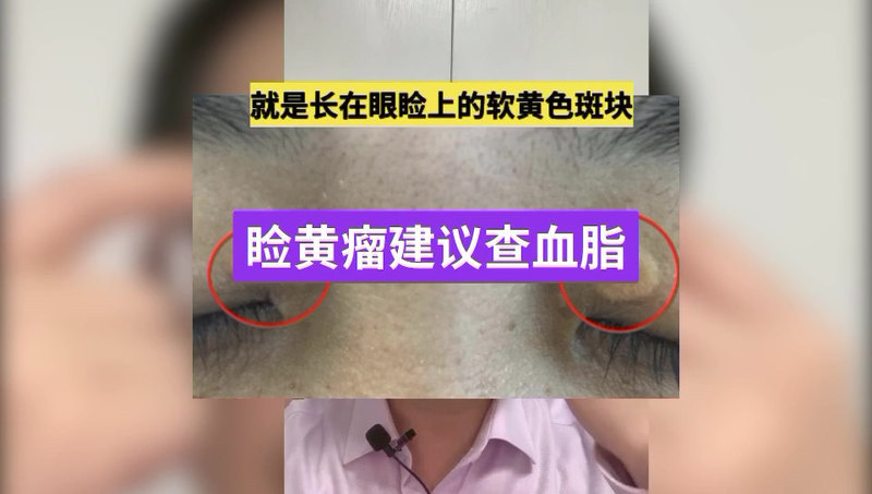 視頻封面