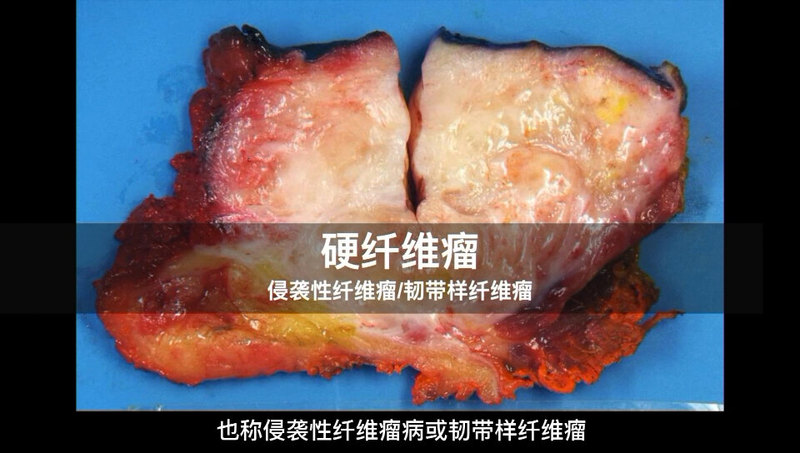 視頻封面
