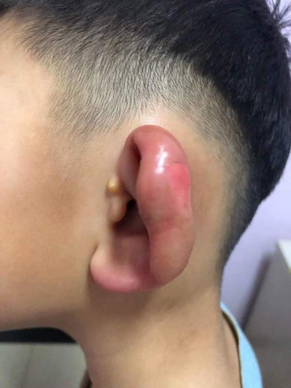 圖文圖片