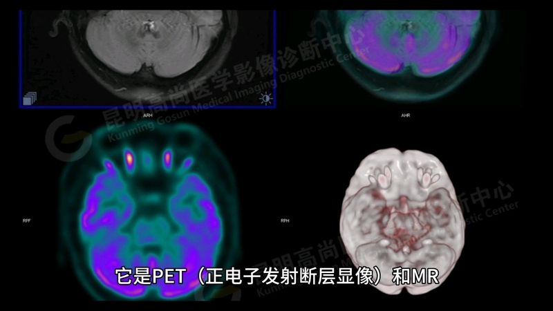 什么是PET-MR