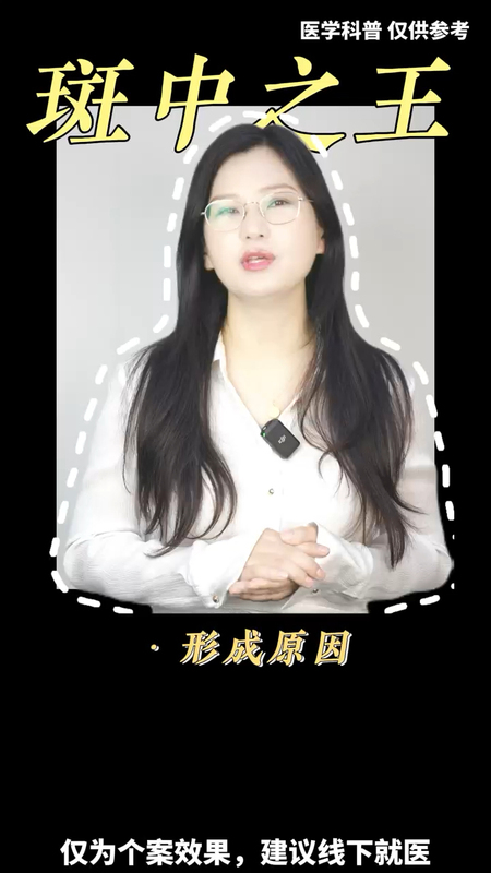 黄褐斑跟着医生抄作业