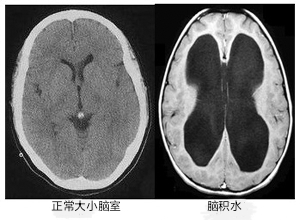 圖文圖片