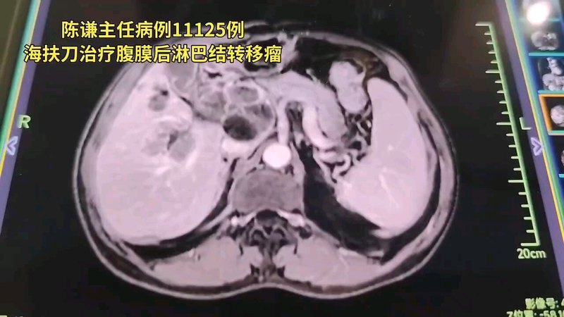 視頻封面