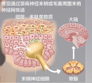 圖文圖片