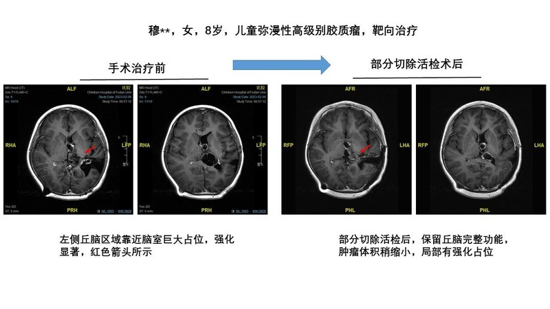 圖文圖片
