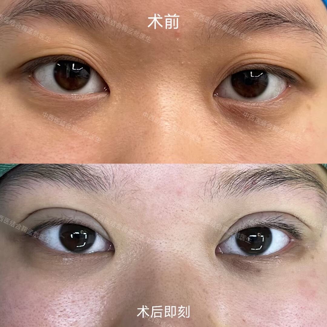 圖文圖片