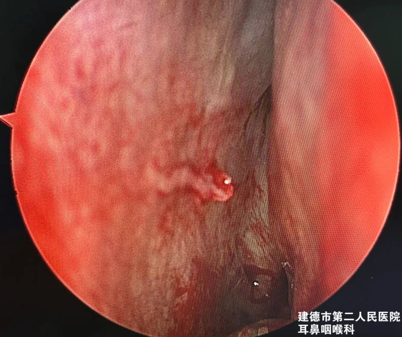 圖文圖片