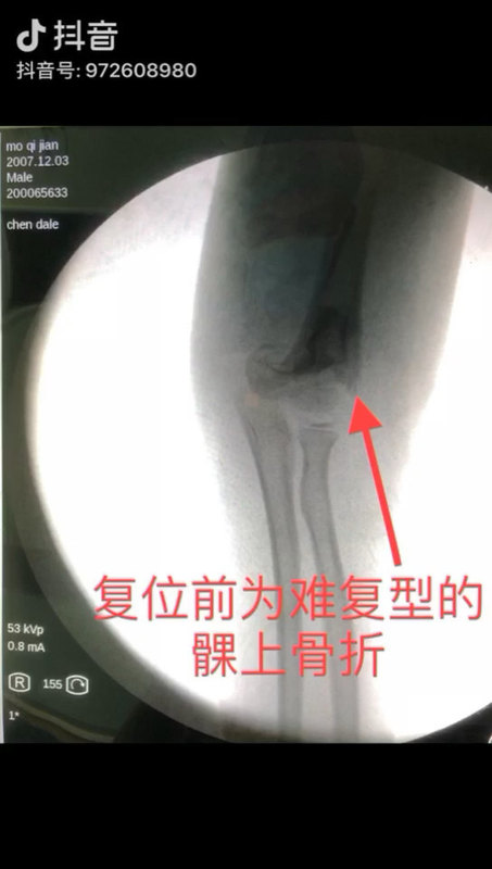 視頻封面