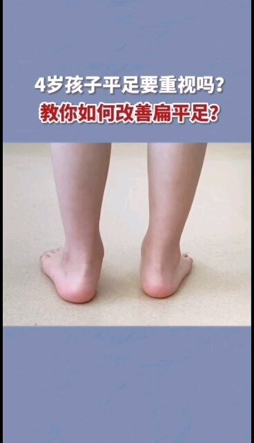 4岁孩子扁平足要重视吗？教你如何改善扁平足？